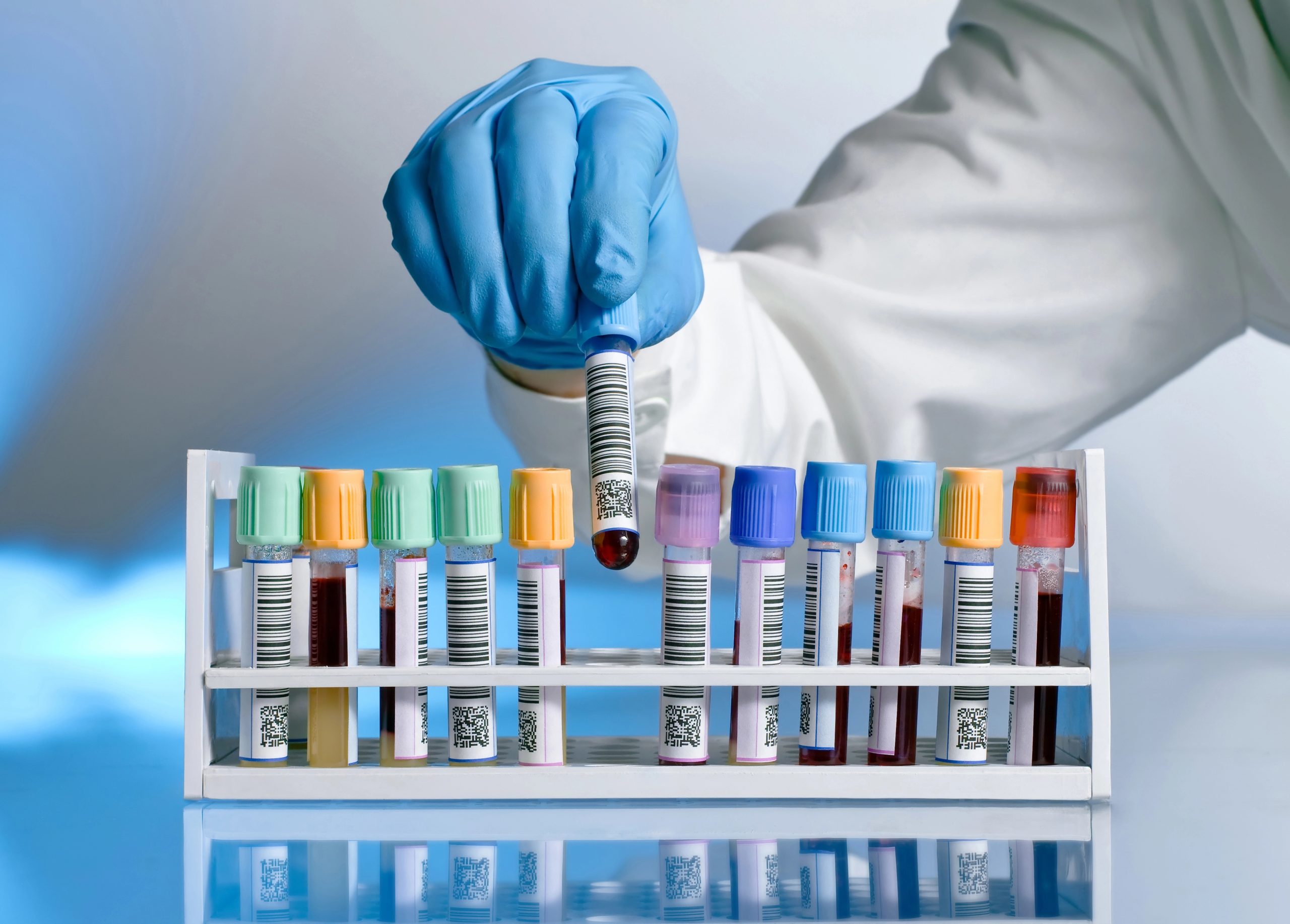 Arlington DWI Cases – Fighting Blood Test Results In Texas